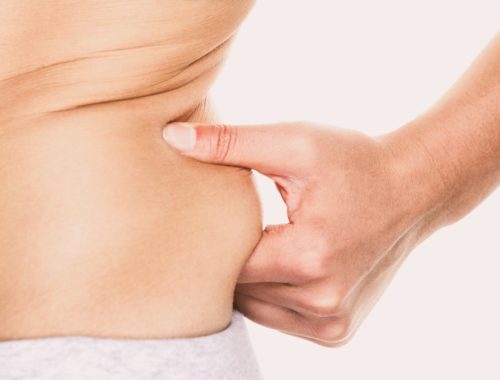 How to Get Rid of Love Handles